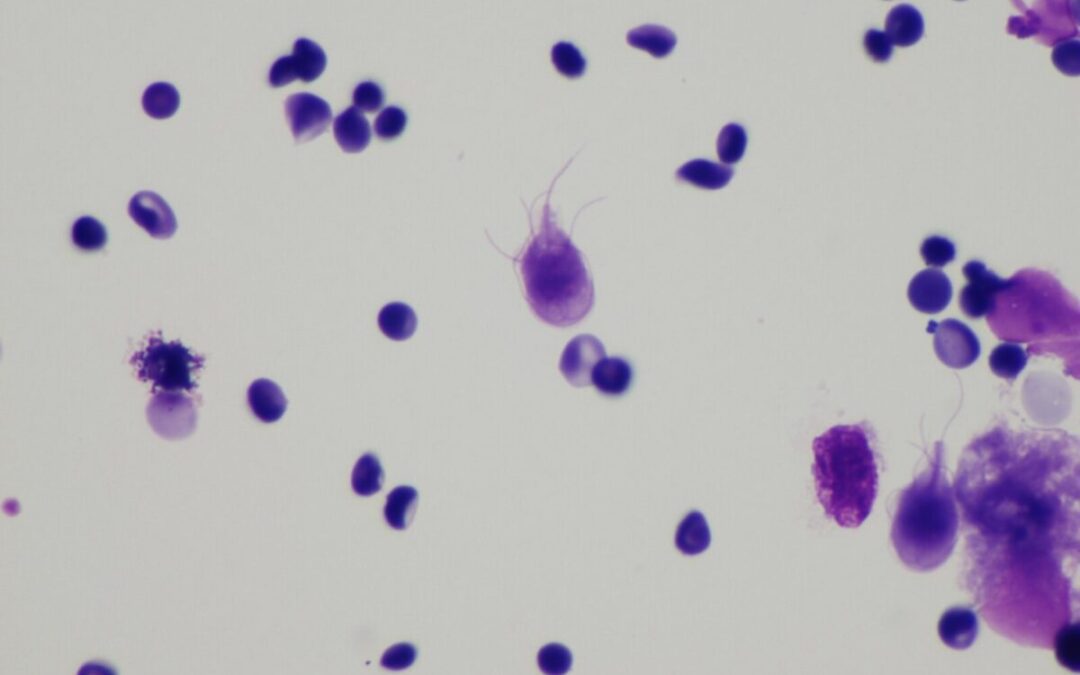 Giardia outbreak tied to Bethlehem spring water